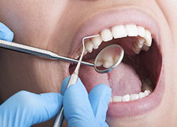 试验中的齿科胶黏剂